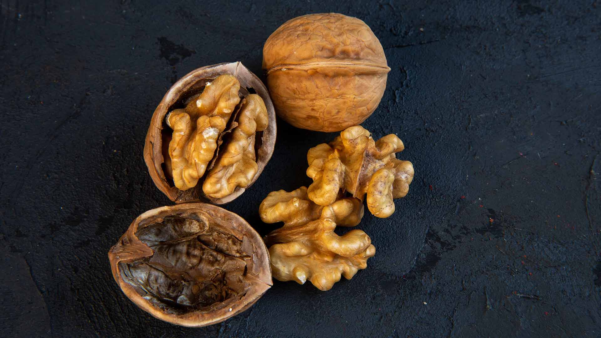 Nüsse: Wie viele Stück sollte man täglich essen, um davon zu profitieren?